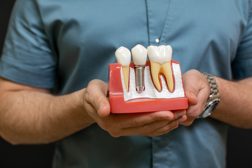 Best Dental Implants in Baner | Dental Hub Hinjewadi
