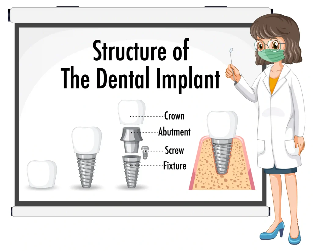Dental Implants in Baner Pune | Dentist Near Me