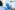 Dental Implants in baner A Permanent Solution to Missing Teeth