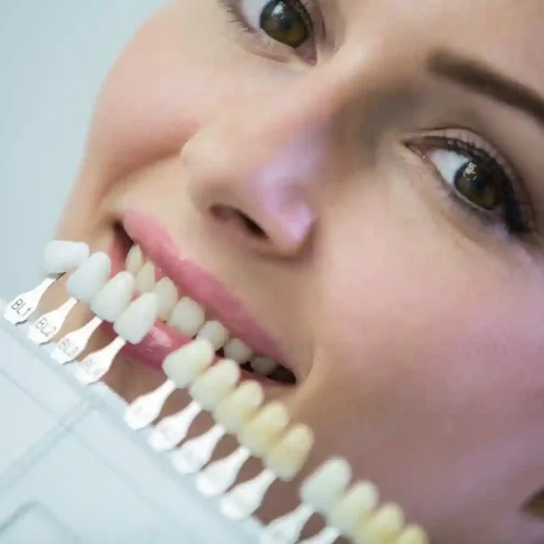 Teeth Whitening